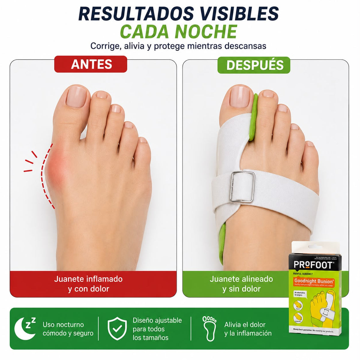 Corrector Nocturno de Juanetes PROFOOT