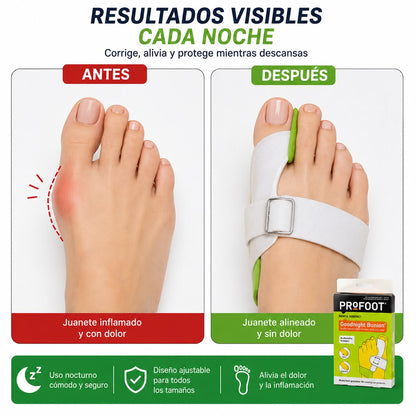 Corrector Nocturno de Juanetes PROFOOT